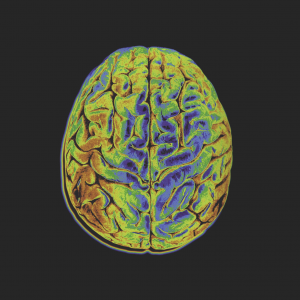 Montreal Neurological Institute